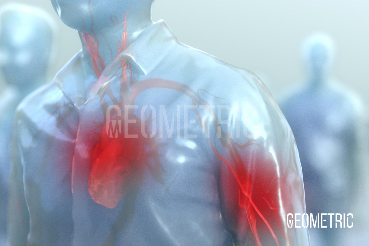 Cardiovascular Implant Animation