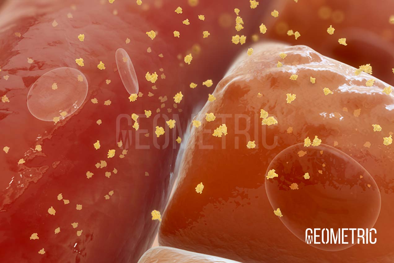 Congenital Hyperinsulinism Animation