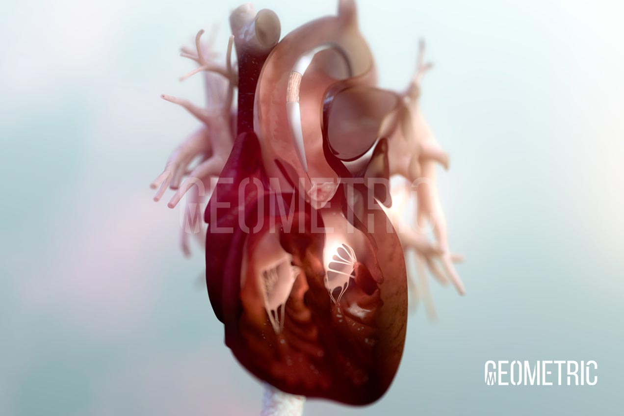Cardiovascular Animation by Geometric