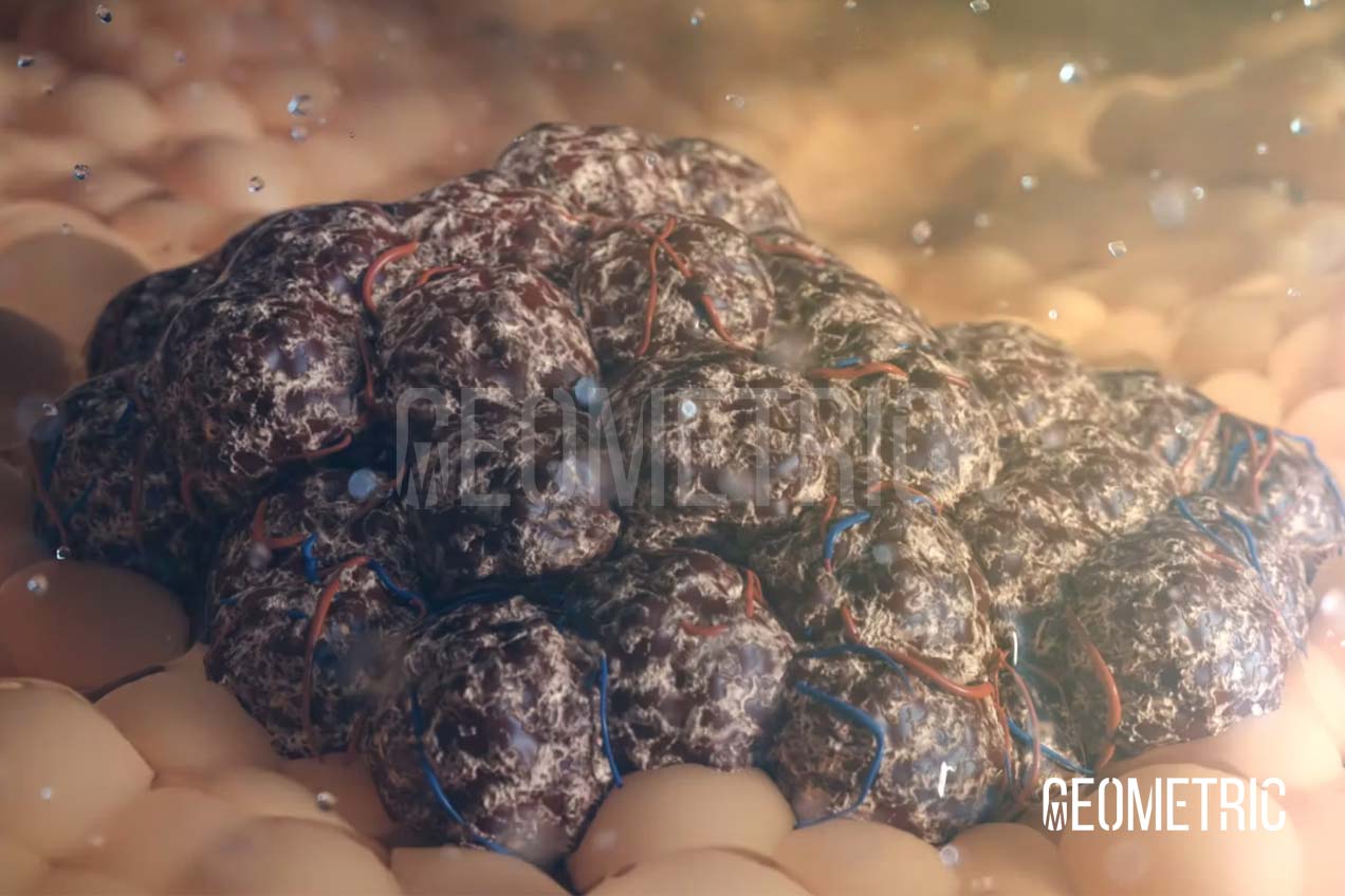 Cancer Animation by Geometric